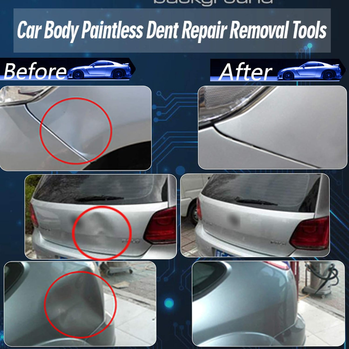 88pcs Paintless Dent Repair Kit Q972